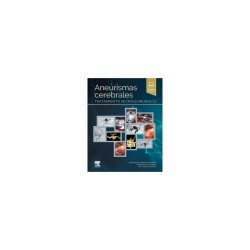 González - Aneurismas cerebrales - Elsevier