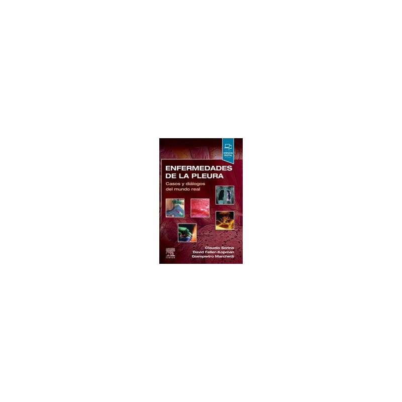 Sorino - Enfermedades de la pleura - Elsevier 2022