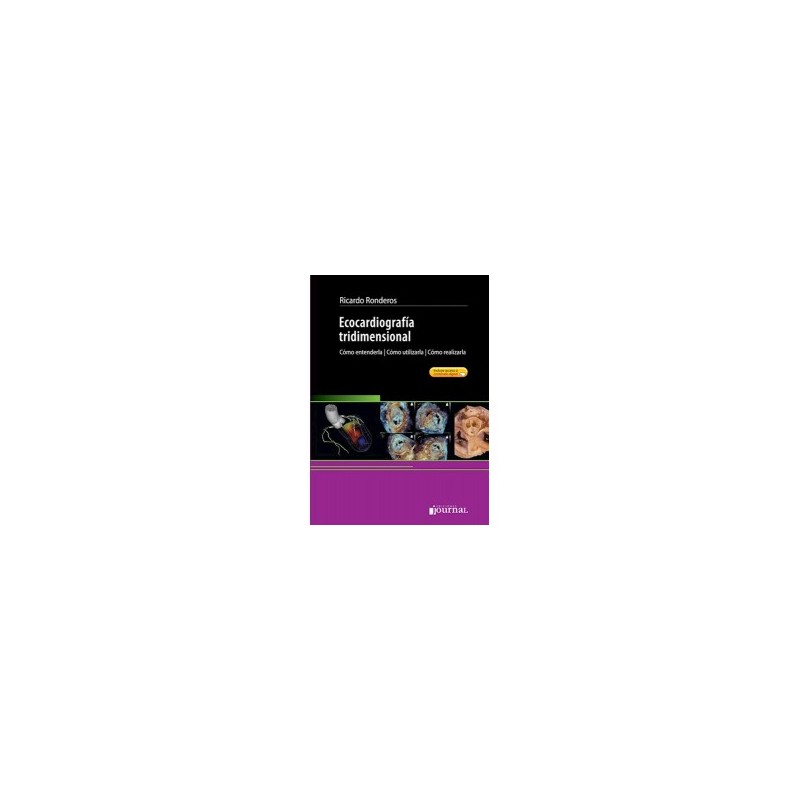 Ronderos - Ecocardiografía tridimensional - Journal