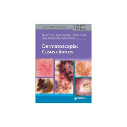 Cabo - Dermatoscopia: Casos clínicos - Journal