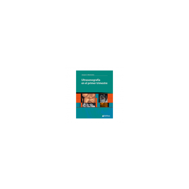 Abramowicz - Ultrasonografía en el primer trimestre - Journal
