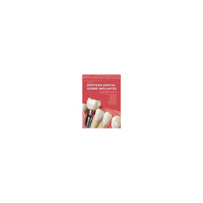 Del Río - Prótesis dental  sobre implantes - Lisermed