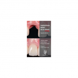 Malet - Implantología dental de un vistazo - Lisermed