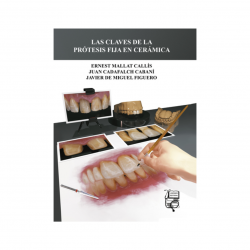 Mallat - Las claves de la prótesis fija en cerámica - Lisermed