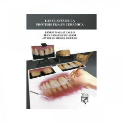 Mallat - Las claves de la prótesis fija en cerámica - Lisermed
