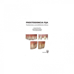 Fons - Prostodoncia fija - Lisermed
