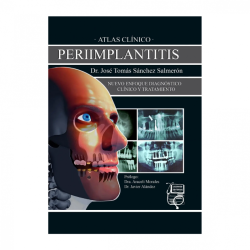 Sánchez - Atlas clínico Periimplantitis - Lisermed