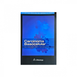 Marini - Carcinoma basocelular - Alfaomega