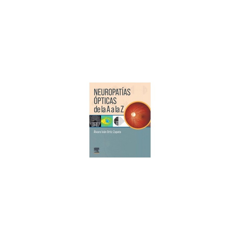 Ortiz - Neuropatías ópticas de la A a la Z - Elsevier 2024