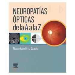 Ortiz - Neuropatías ópticas de la A a la Z - Elsevier 2024
