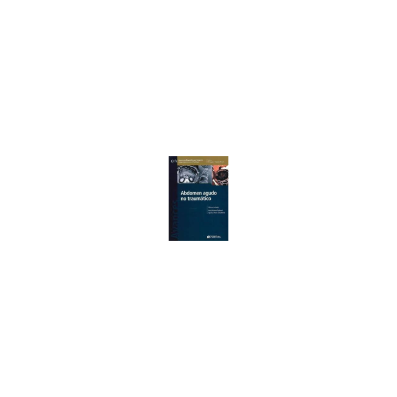 Kimura - Abdomen agudo no traumático - Journal 2014