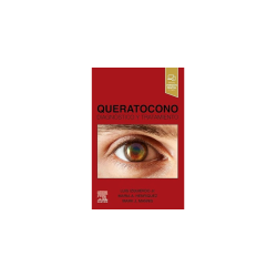 Izquierdo - Queratocono diagnóstico y tratamiento - Elsevier 2024