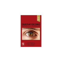 Izquierdo - Queratocono diagnóstico y tratamiento - Elsevier 2024