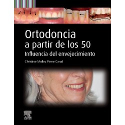 Muller - Ortodoncia a partir de los 50 - Elsevier 2025
