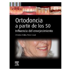 Muller - Ortodoncia a partir de los 50 - Elsevier 2025