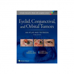 Shields - Eyelid, conjuntival and orbital tumors 3Ed - Wolters Kluwer