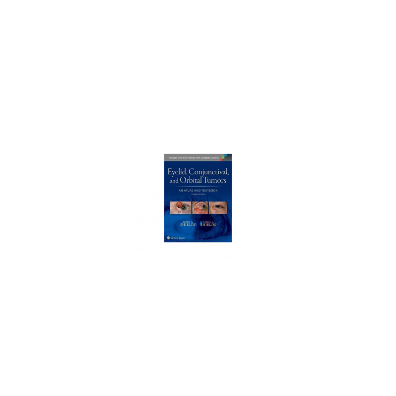 Shields - Eyelid, conjuntival and orbital tumors 3Ed - Wolters Kluwer