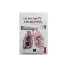 Rincón - Ultrasonografía pulmonar - Zarpra